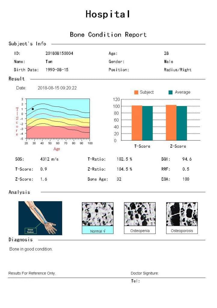 Radium/Tibia Ultrasound Bone Sonometer BD09