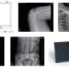 Digitales Röntgen mit dem Röntgendetektor ecoRAY FP01 – Bild 6