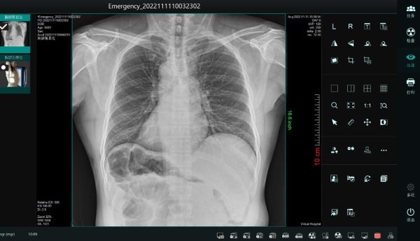 Digitales Röntgen mit dem Röntgendetektor ecoRAY CV38