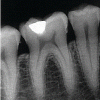 Dentalröntgen ecoRAY DX14 – Bild 4