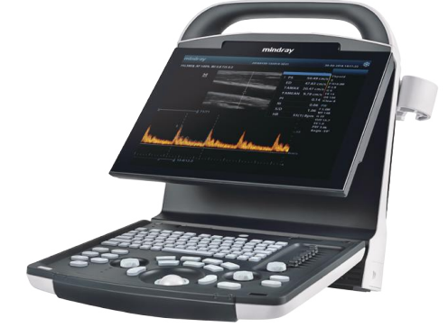 Mobiles Ultraschallgerät Mindray DP-10 – Schwarz-Weiß, Tragbar und Leistungsstark – Bild 3