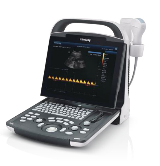 Mobiles Ultraschallgerät Mindray DP-10 – Schwarz-Weiß, Tragbar und Leistungsstark – Bild 4
