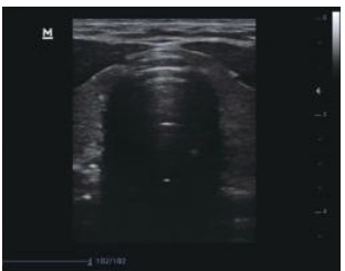 Mobiles Ultraschallgerät Mindray DP-10 – Schwarz-Weiß, Tragbar und Leistungsstark – Bild 7