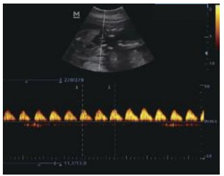 Mobiles Ultraschallgerät Mindray DP-10 – Schwarz-Weiß, Tragbar und Leistungsstark – Bild 5