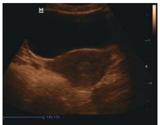 Mobiles Ultraschallgerät Mindray DP-10 – Schwarz-Weiß, Tragbar und Leistungsstark – Bild 2