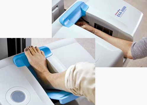 EXA 3000 – Präzise Knochendichtemessung in Sekunden zur Miete – Bild 2